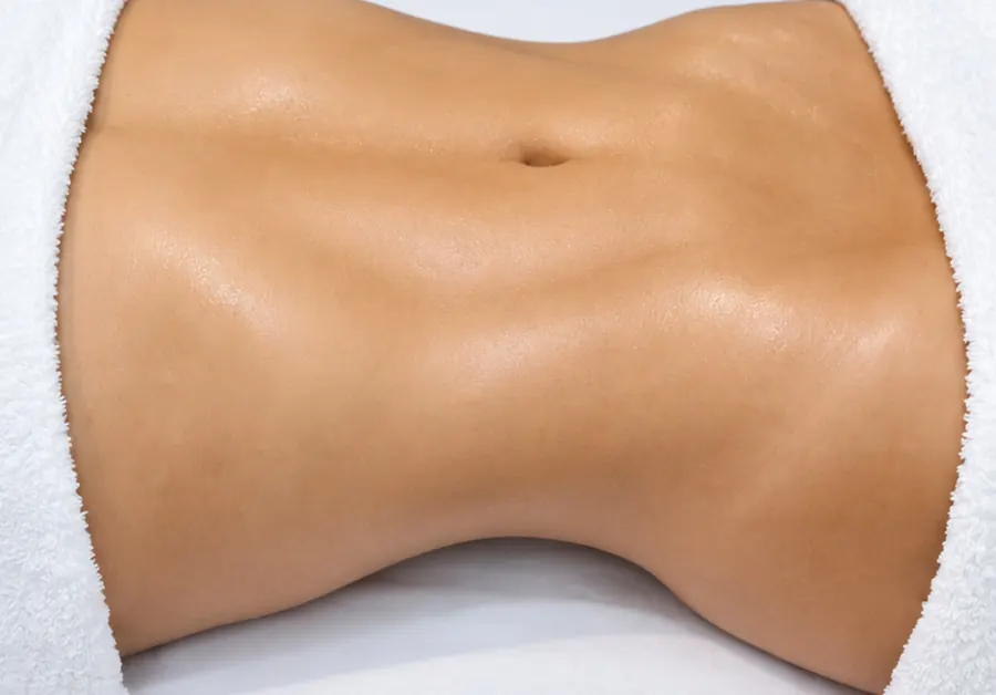 Abdomen: después del procedimiento en Munay Esthetic